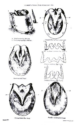 PLATE XXXV.