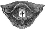 image not available
