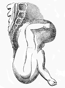 Descent
of the shoulder and trunk