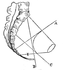 Passage
of the Pelvis