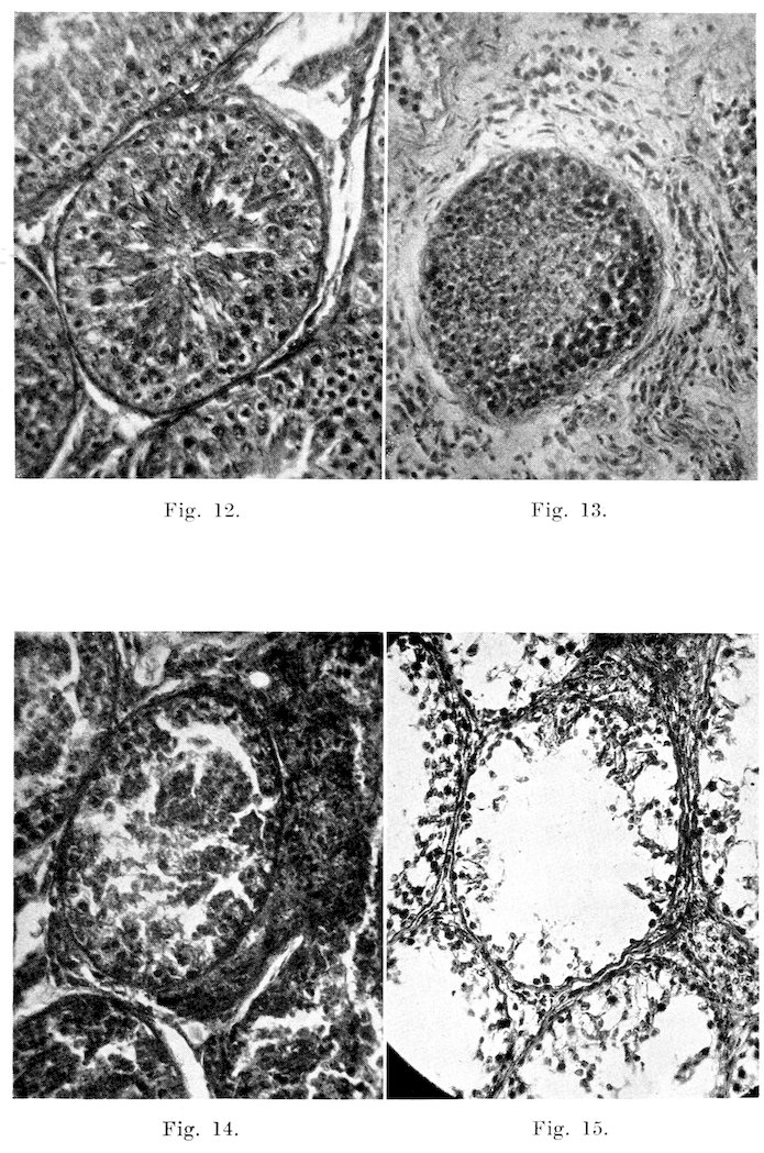 Fig. 12. Fig. 13. Fig. 14. Fig. 15.